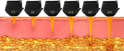 Linear focused-ultrasound head treatment depths