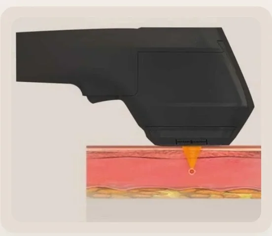 Flat head contact and treatment depth diagram