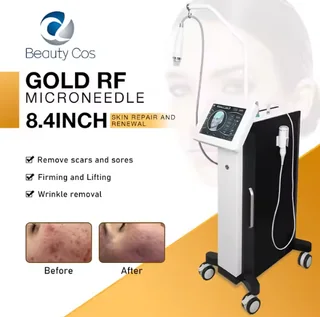 Multifunctional Skin Tightening Machine | Wrinkle Remover & Face Lift with Vacuum Tech - image 3